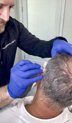 Hair Restoration Services
