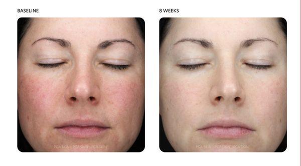 Iron Apron Esthetics