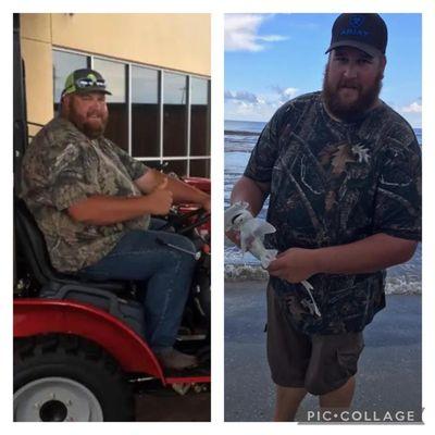 Patient down 140lbs!