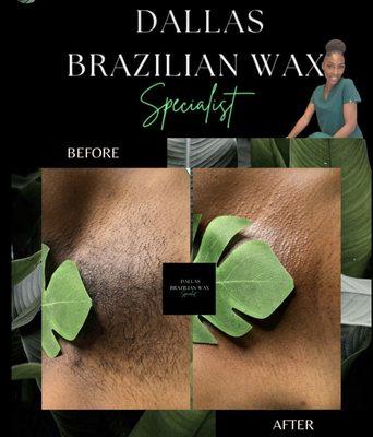 Dallas Brazilian Wax Specialist
