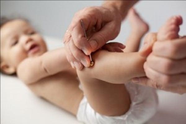 Pediatric Shonishin, acupressure offered at Perfect Ohm, a holistic healthcare clinic servicing North Miami Beach, FL.
