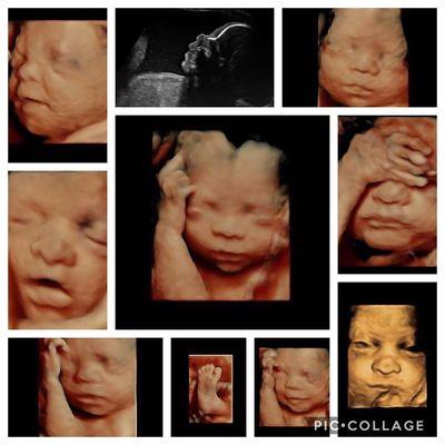 Image of Love Ultrasound