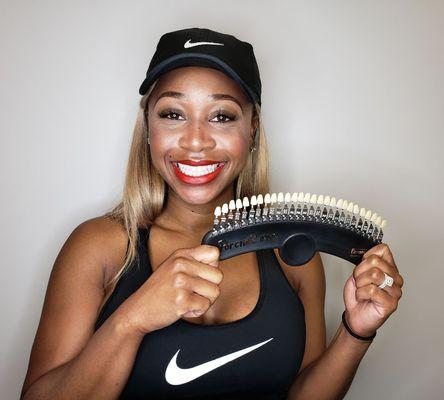 Gems Teeth Whitening