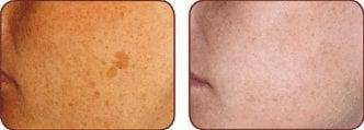 Rajeunir Medical Spa