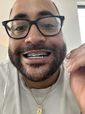 Working on my smile.