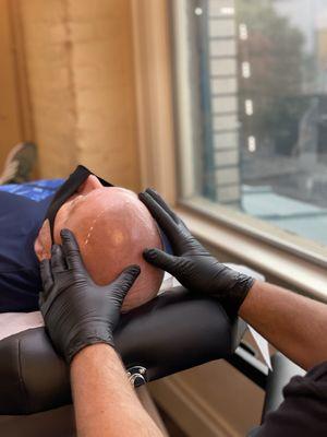 Working on natural hairline shape.