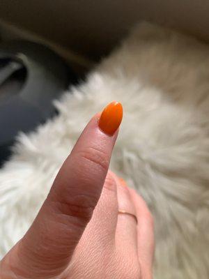 Cut along my cuticle on pinkie from drill