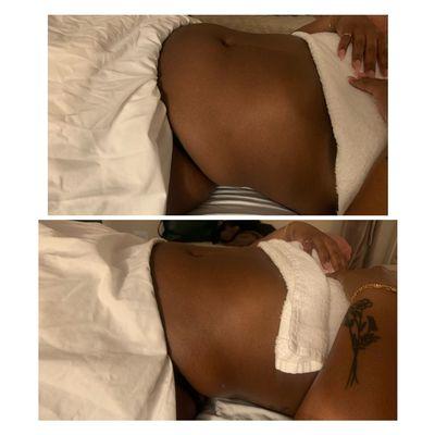 Full body lymphatic massage