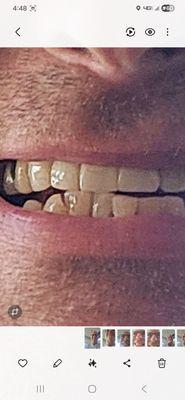 My much better mug after