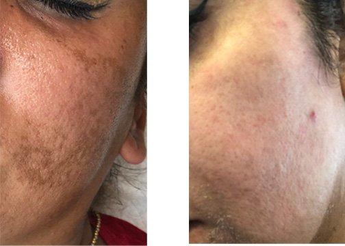 The Ultimate Solution by LaNora Shepherd