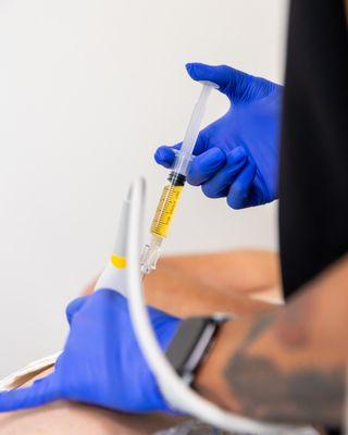 Guided PRP Injection for Hip Pain