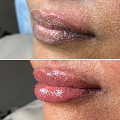 Lip color correction