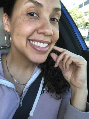 My teeth after cleaning