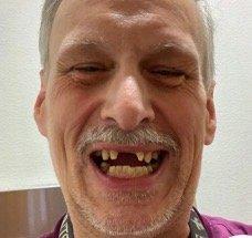 Pacific Oral Surgery & Implants