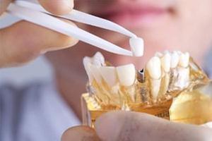 Glenn B Miller, DDS