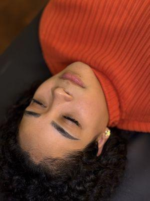 Microblading scarred