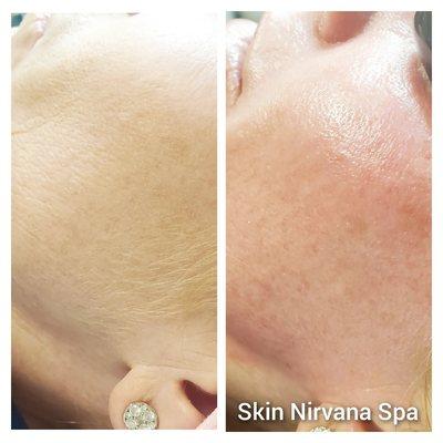 Skin Nirvana Spa