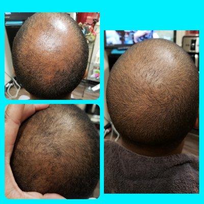 Royalty Treatment Haircare Center