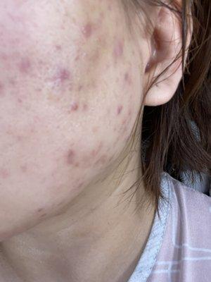 Peebro Skin & Total Health Care