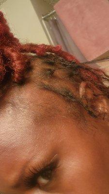 Braids tooooo small and adding hair only made it very heavy. So heavy it pulled out my sides