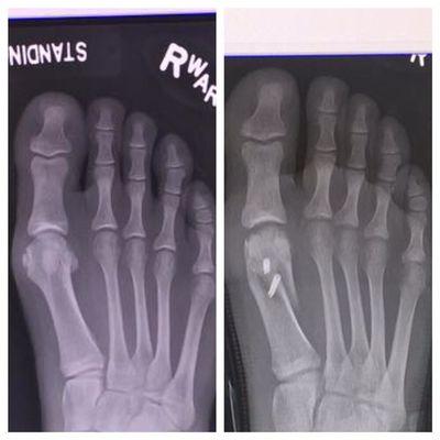 Northwest Orthopedic Surgery