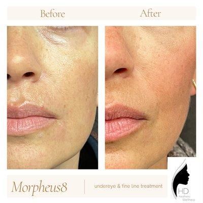 HD Aesthetic Wellness