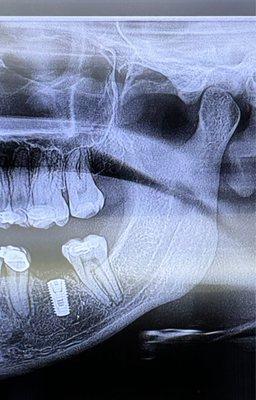 Advanced Dentistry by Soboh Liswi Tedini