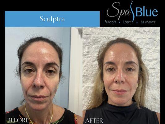 Spa Blue
