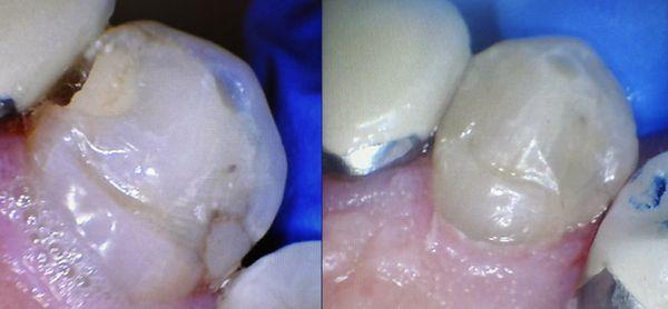 Cal Dental Of Buena Park