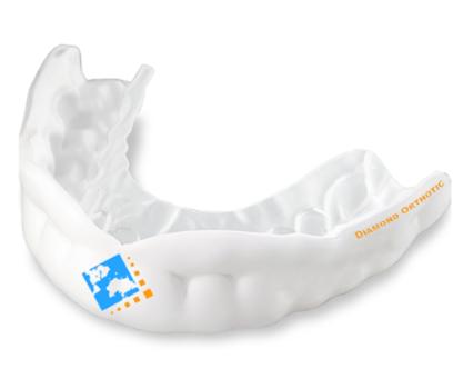 Sports Mouthguard www.diamondorthoticlab.com