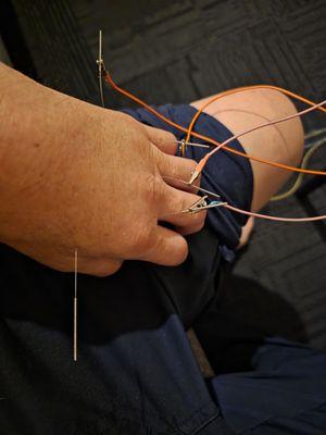 Joanna Zhang, LAC PHD