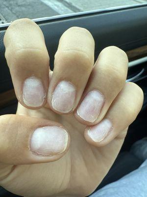 T-Neck Nails