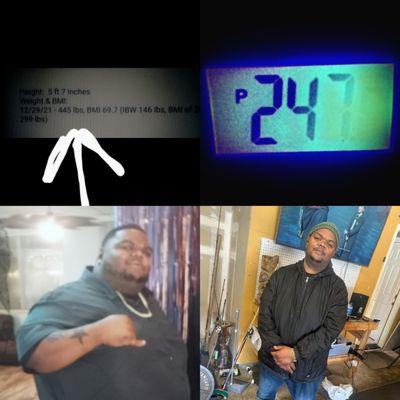 Big changes!!!! #gastrosleeve patient