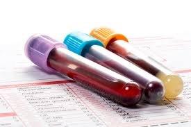 Blood Analysis