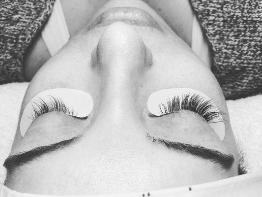 Left eye after 4 weeks. Right eye fresh fill.