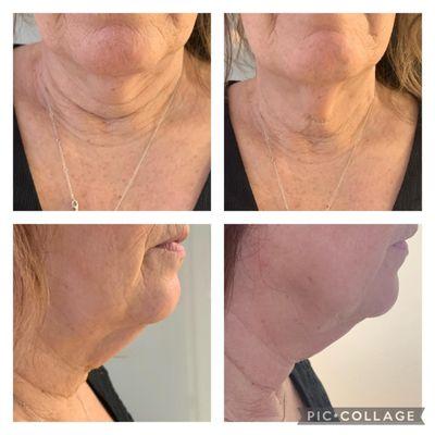 Skin Tight Aesthetics