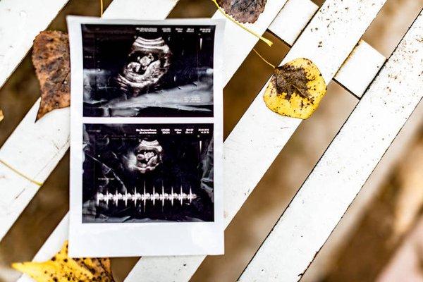Precious Glance Ultrasound