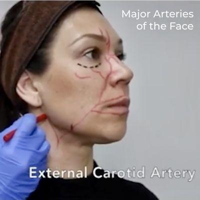 Anatomical safety is carefully monitored