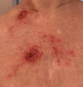 Curtin Timothy, MD - Anne Arundel Dermatology