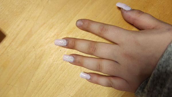 Nails, 1 of which has come off completely and 2 she glued back on.