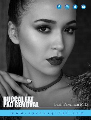 Buccal Fat Removal