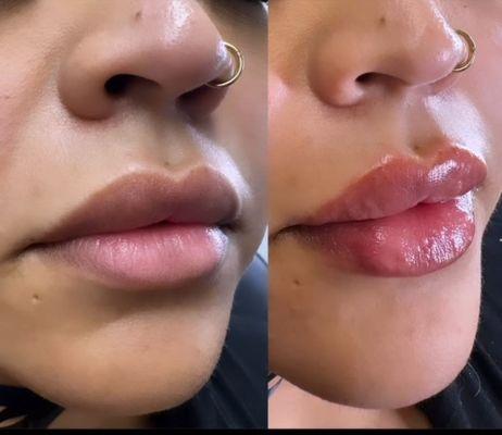 Pretty & Plumped Aesthetics