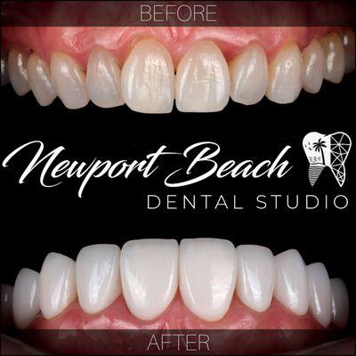 Newport Beach Dental Studio