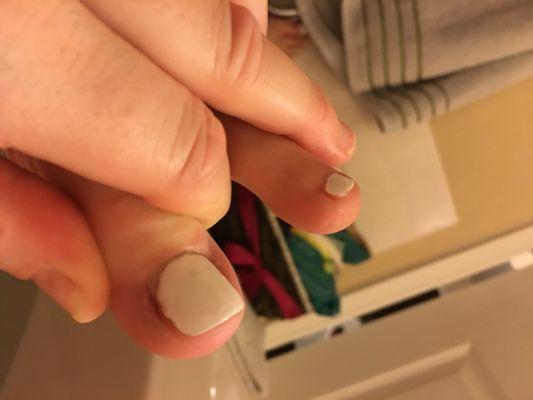 They cut me really bad.