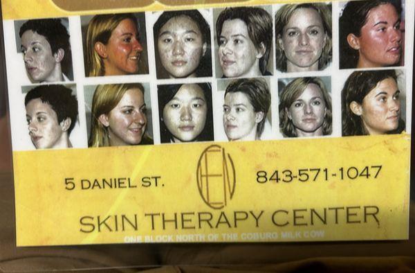 Skin Therapy Center Clinic For Acupuncture
