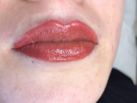 Full lips immediately after
