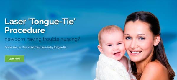 laser tongue tie surgery in troy mi