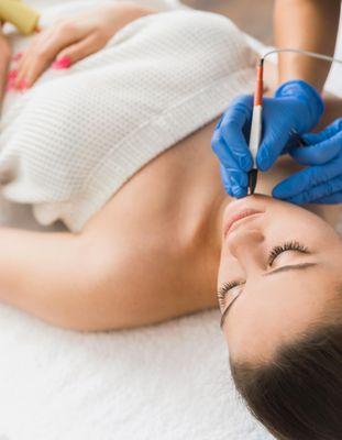 Permanent Hair Removal via Electrolysis