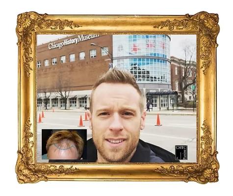 Chicago Hair Transplant Clinic