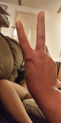 Security bent my finger back breaking my nuckle